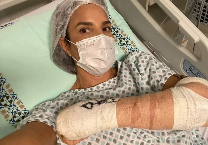 Ivete Sangalo com o braço quebrado