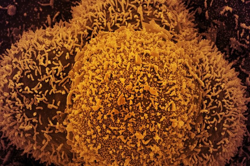coronavírus