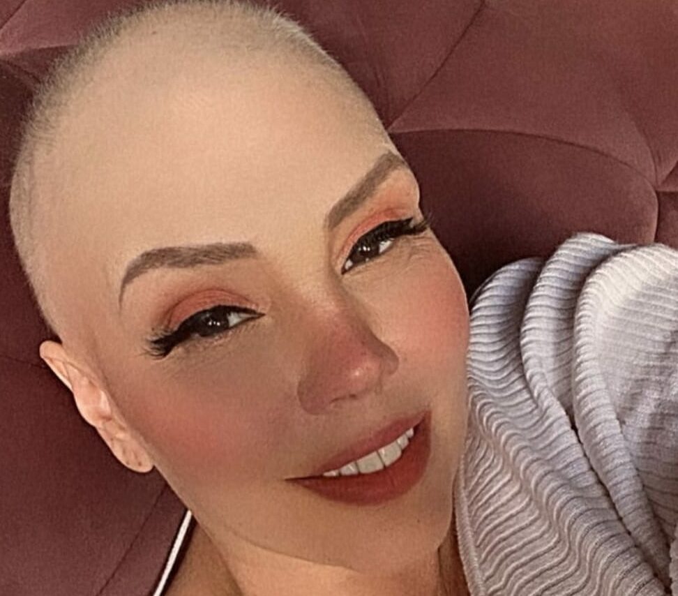 Simony careca