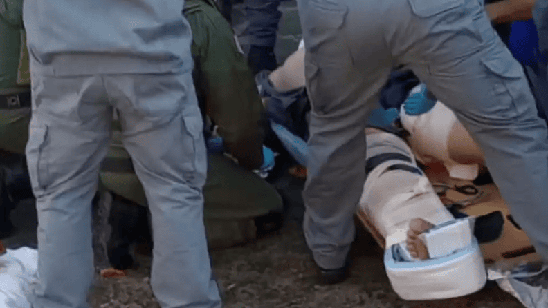 policial ferido na perna
