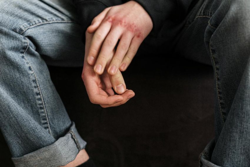 Comunidade terapeutica praticava agressões e tortura contra internos