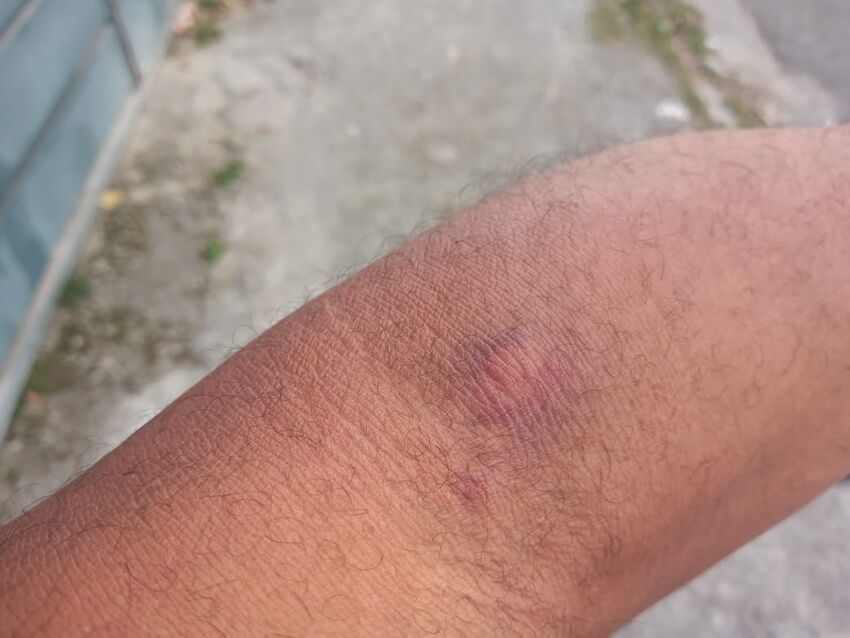 braça de homem 