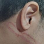 agressão de jovem