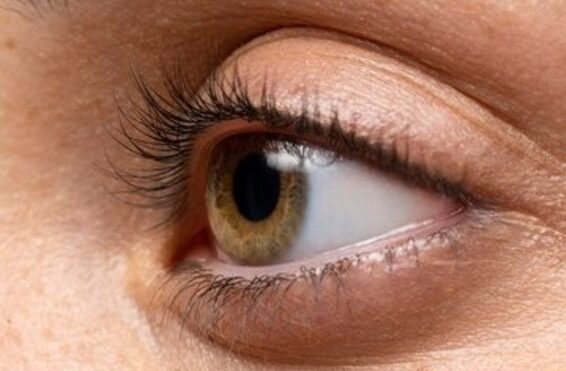 H.Olhos recomenda 5 cuidados para prevenir o Olho Seco no período do inverno