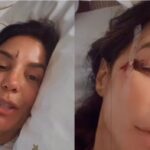 Ivete Sangalo é internada em Salvador após desmaio e ferimentos no rosto