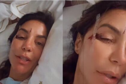 Ivete Sangalo é internada em Salvador após desmaio e ferimentos no rosto