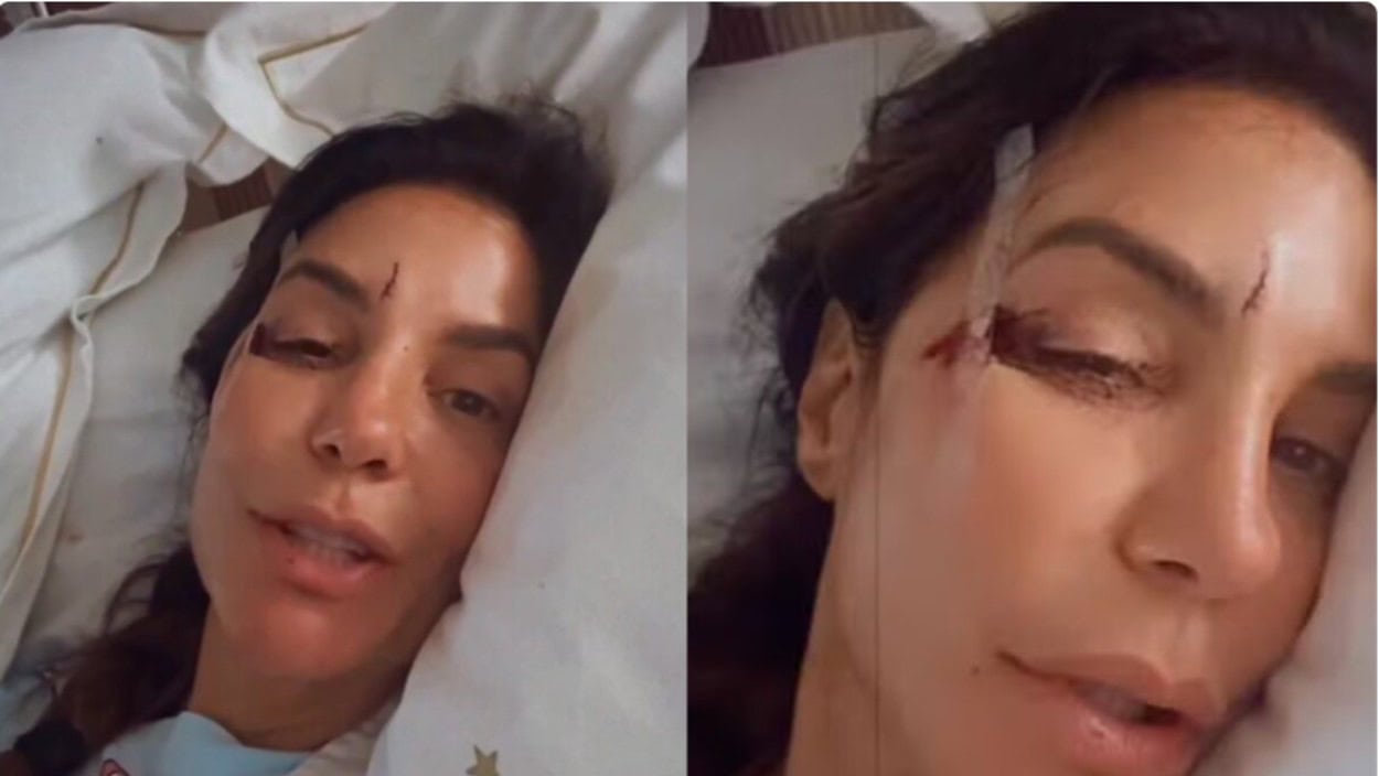 Ivete Sangalo é internada em Salvador após desmaio e ferimentos no rosto