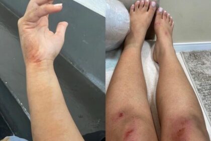 Jovem que se jogou de carro de app em Santo André recua e diz que caso foi "mal-entendido"