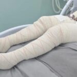 Vítima teve queimaduras graves em diversas partes do corpo e encontra-se internada