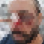 Em São Bernardo, enfermeiro tem rosto fraturado após ser agredido em consultório na UPA Demarchi