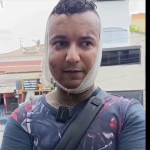 Vítima foi ferida por criminosos durante tentativa de assalto em Santo André
